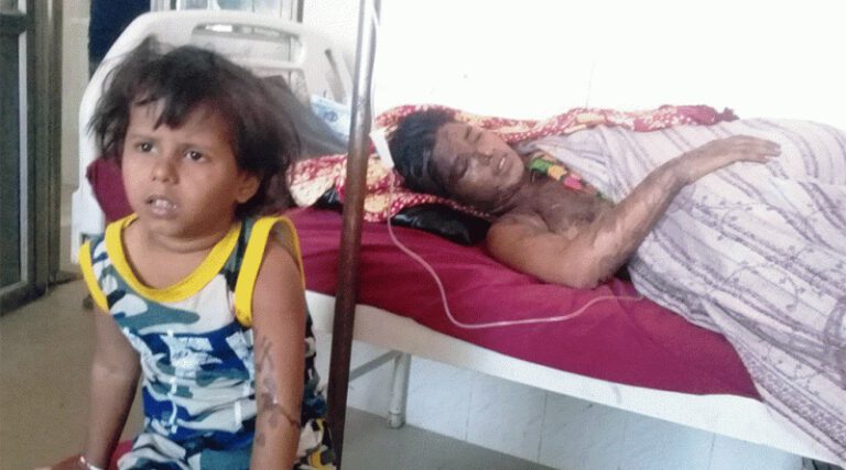 तेजाब पीडित आरती : यतिखेर जिन्दगीकालागि संघर्ष गरिदै