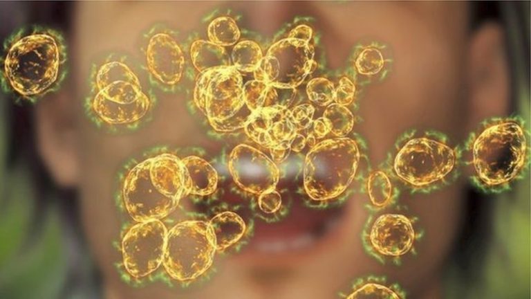 नेपालका विभिन्न १० जिल्लामा बर्ड फ्लूको सङ्क्रमण फैलियाे