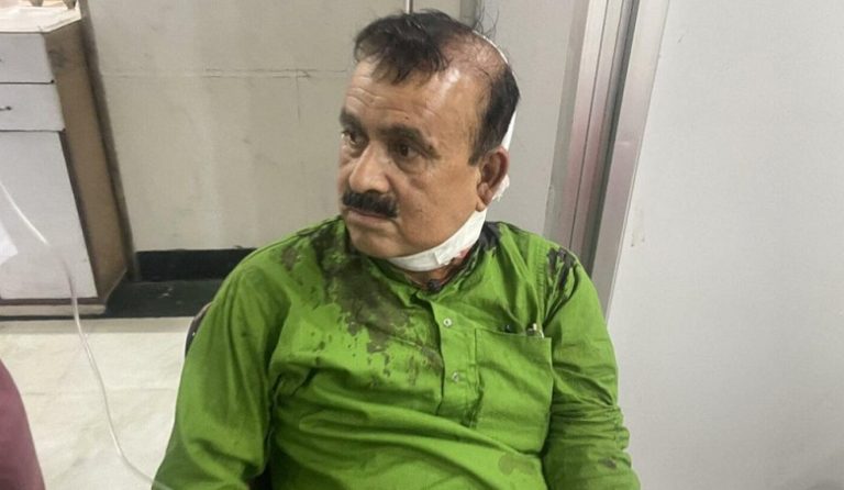 कांग्रेस सहमहामन्त्री यादवमाथि खुकुरी प्रहार, एकजना पक्राउ